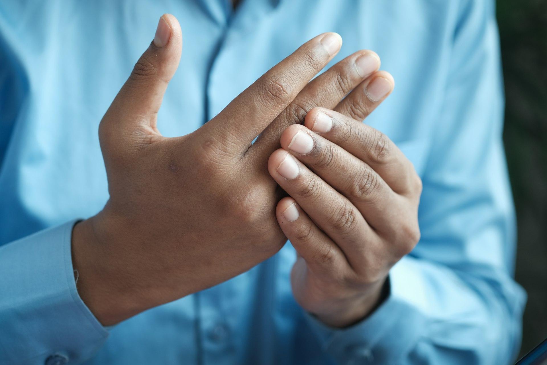 Arthritis pain in hands
