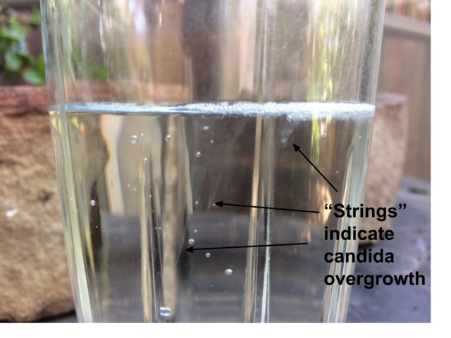Candida spit test results for candida cleanse using High Vibe Health 100% Gum Spirits of Turpentine from The Garden of Eden