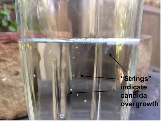 Free at home spit test for candida